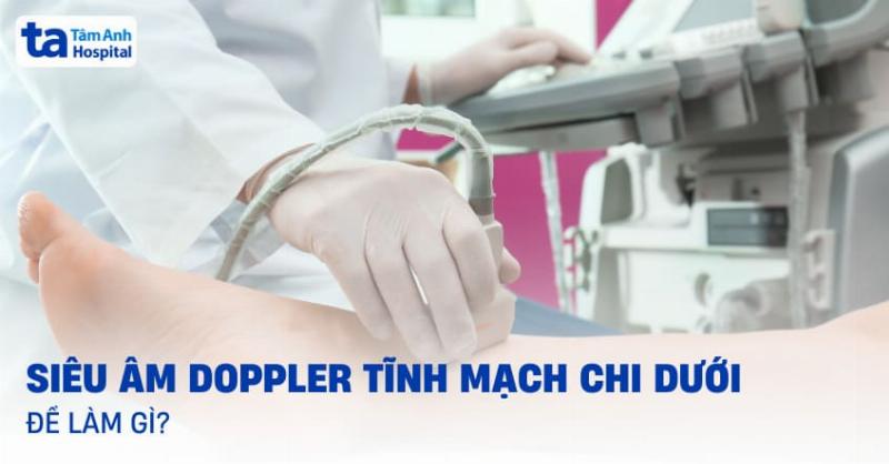 Hinh anh sieu am doppler tinh mach chan doan suy van tinh mach sau chi duoi hai ben